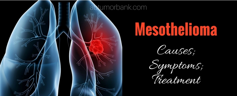 Mesothelioma