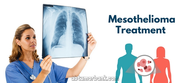 Top 4 Treatment Options for Mesothelioma
